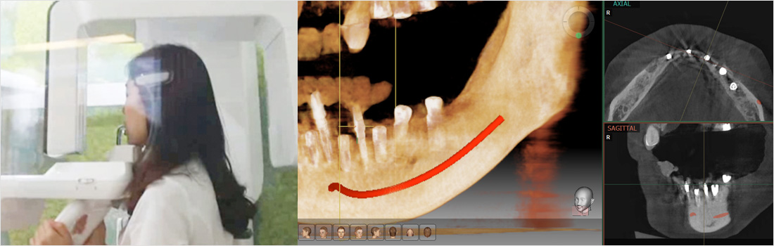 스마트 3D 치아교정