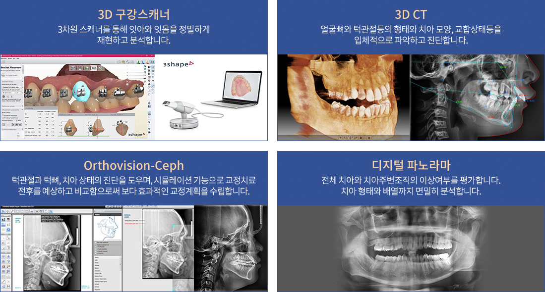 스마트 3D 치아교정